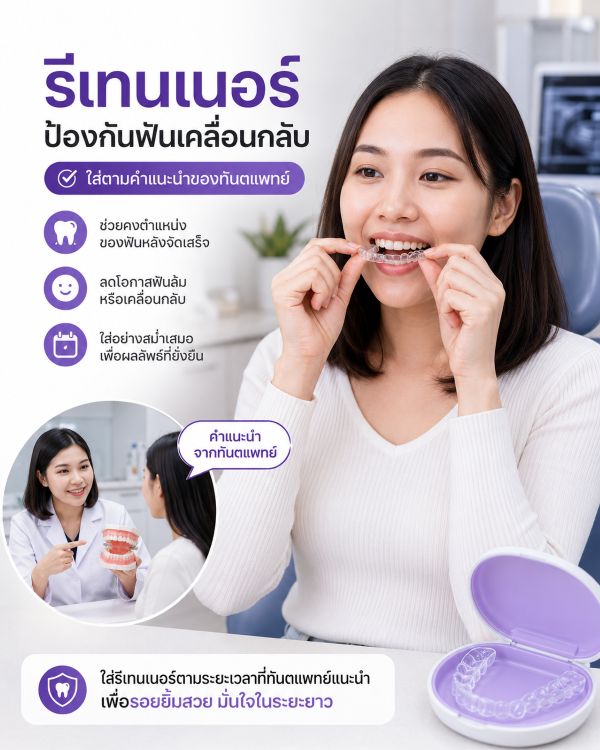 รีเทนเนอร์ retainer D-Smile ขอนแก่น