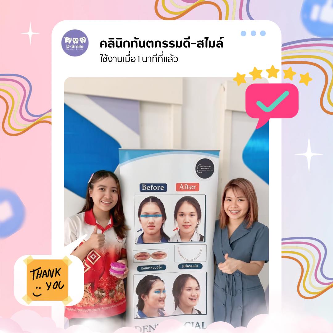 รีวิวจัดฟันใส D-Smile