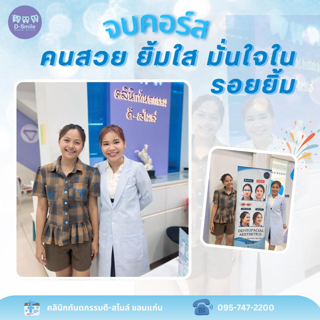 รีวิวจัดฟัน D-Smile