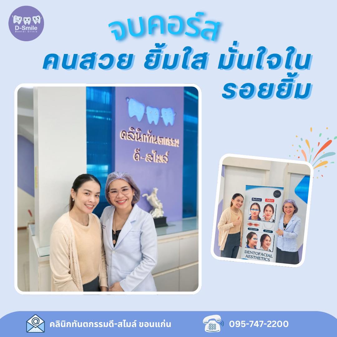 รีวิวรักษารากฟัน D-Smile